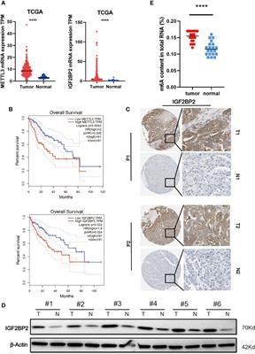 IGF2BP2 Promotes Liver Cancer Growth Through an m6A-FEN1-Dependent Mechanism